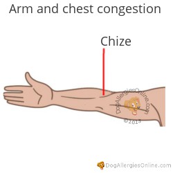 Chest Congestion and Acupoints - Arm